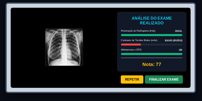 Simulação Radiológica - Resultado realista